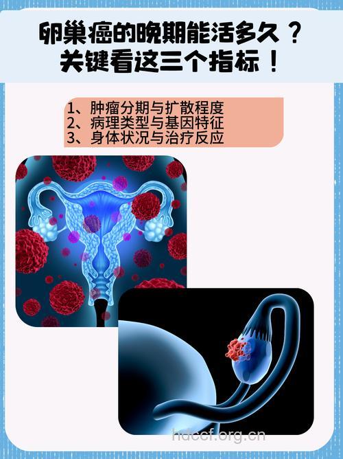 卵巢癌晚期可以活多久