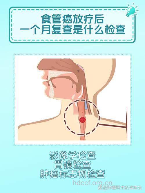 食道癌常见的检查方法