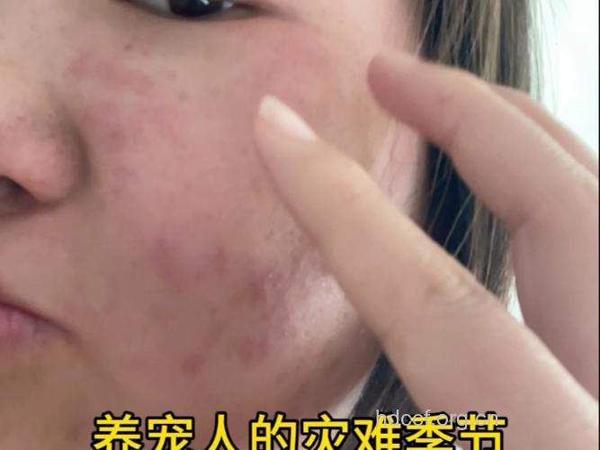 对宠物过敏的人越来越多