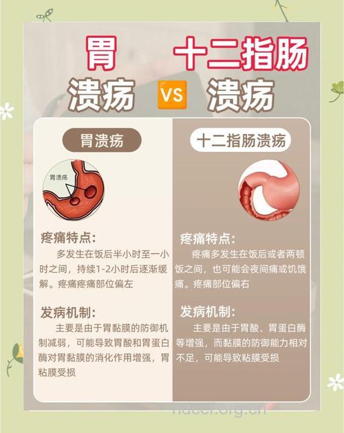 胃溃疡和十二指肠溃疡怎么区别