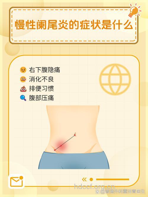 警惕慢性阑尾炎 初期症状要注意