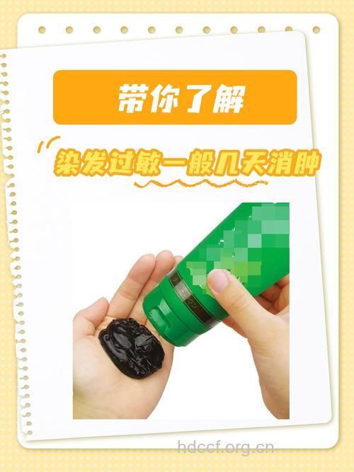 染发会导致皮肤过敏吗 怎样呵护防止过敏