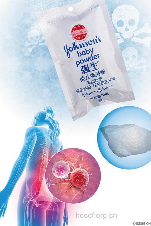 爽身粉遮盖阴道可致卵巢癌吗