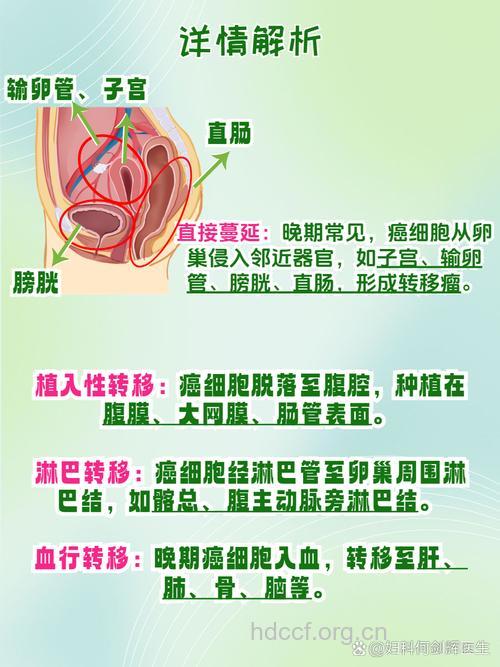 卵巢癌发生和转移与什么有关呢