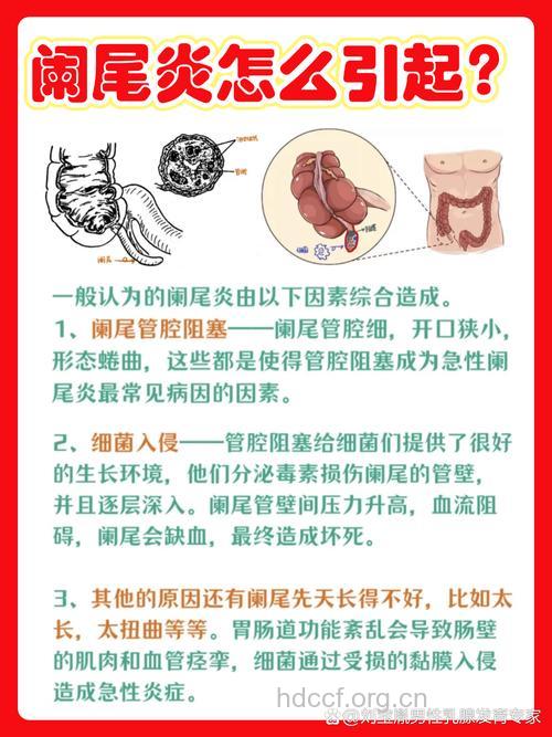 阑尾炎的三大病因