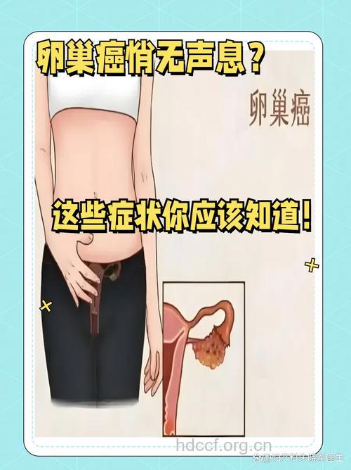 卵巢癌有哪些常见的症状表现呢