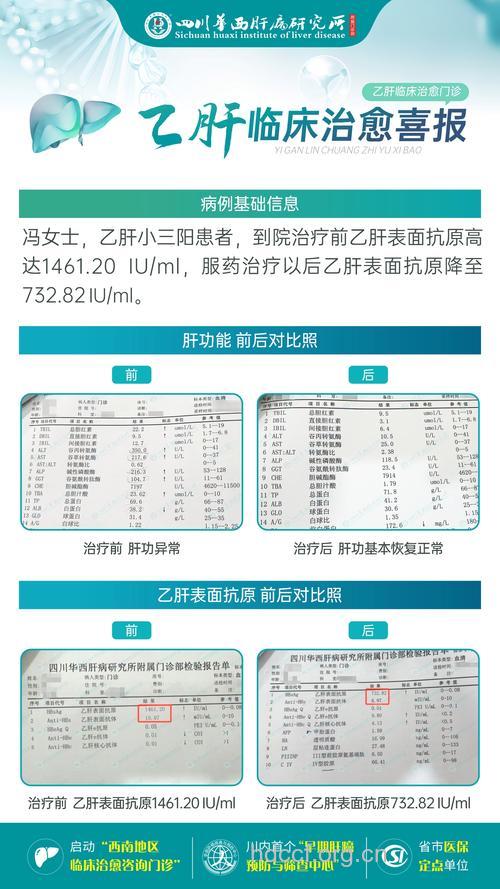乙肝患者治疗标准有哪些