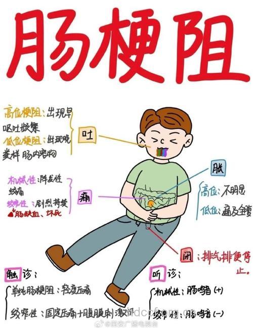 肠梗阻的体征有哪些特点