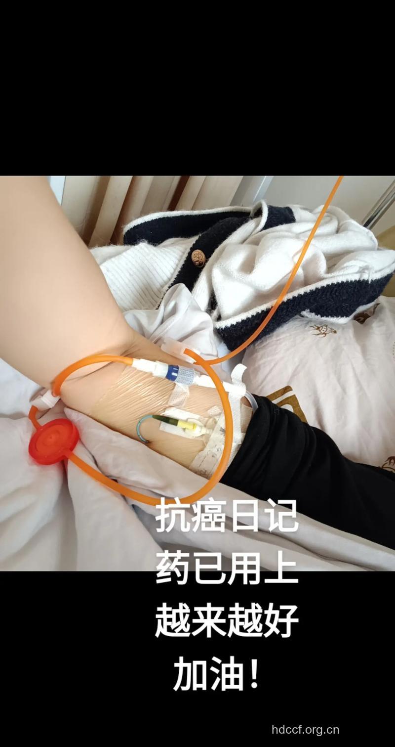 卵巢癌术后有什么症状呢