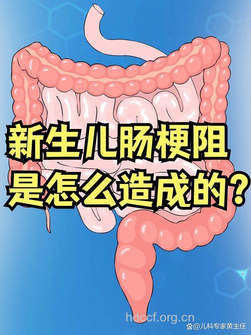 为什么会导致婴儿肠梗阻