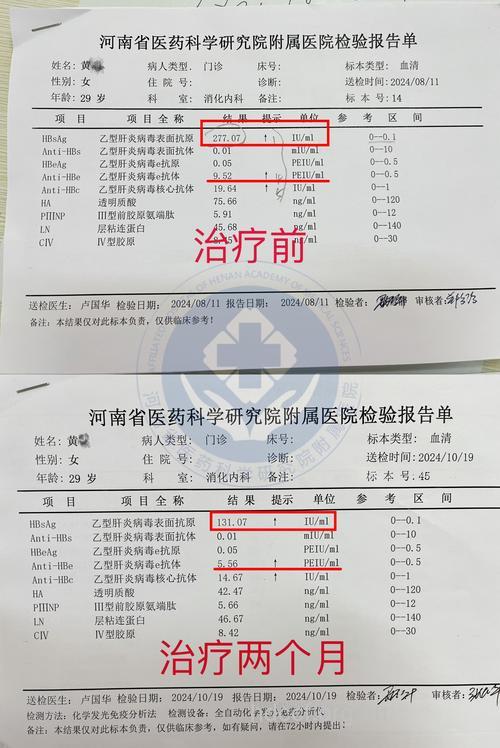 体细胞技术治乙肝获成功
