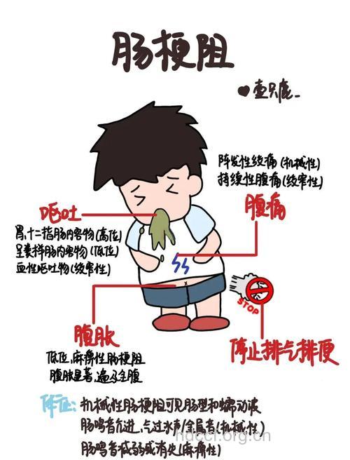 肠梗阻有哪些常见问题