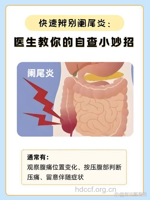 如何诊断阑尾炎
