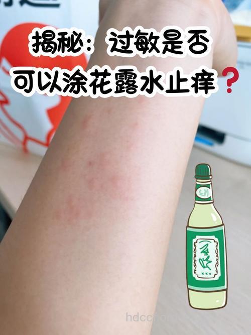 怎么使用花露水会导致过敏