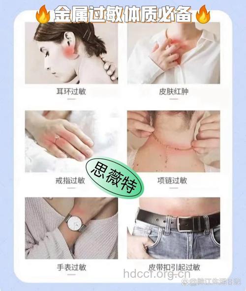 预防金属过敏有哪些妙招