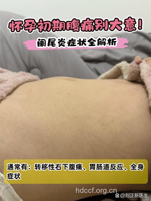 孕妇得了急性阑性炎有哪些症状