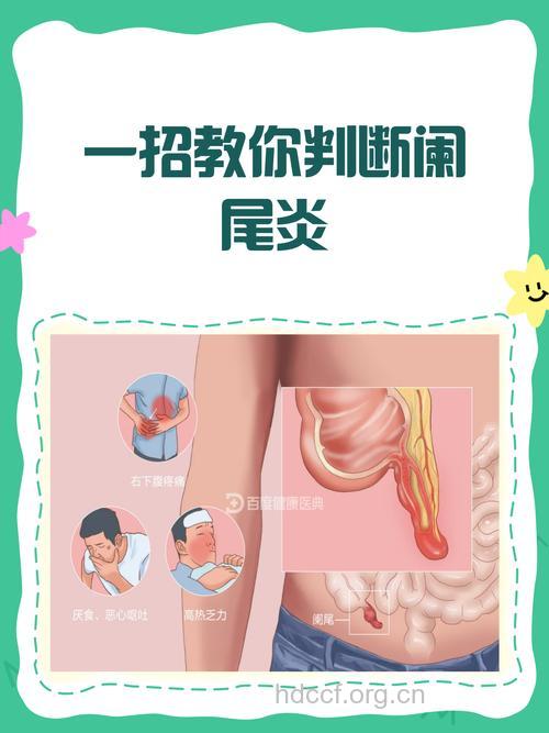 阑尾炎发作是不是把阑尾割了就可 以