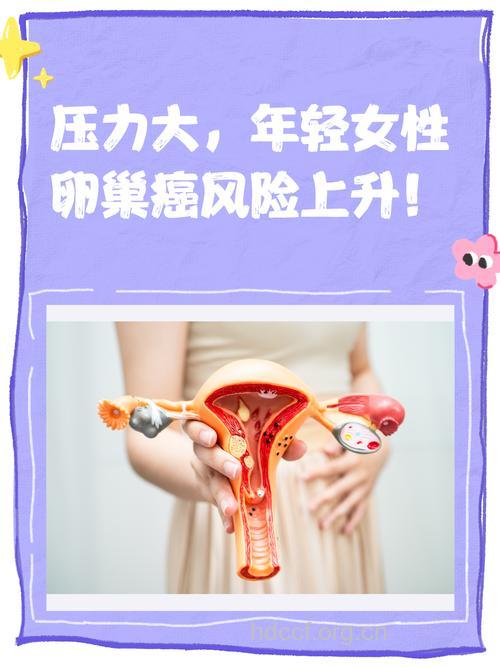 压力大会导致女性患卵巢癌吗