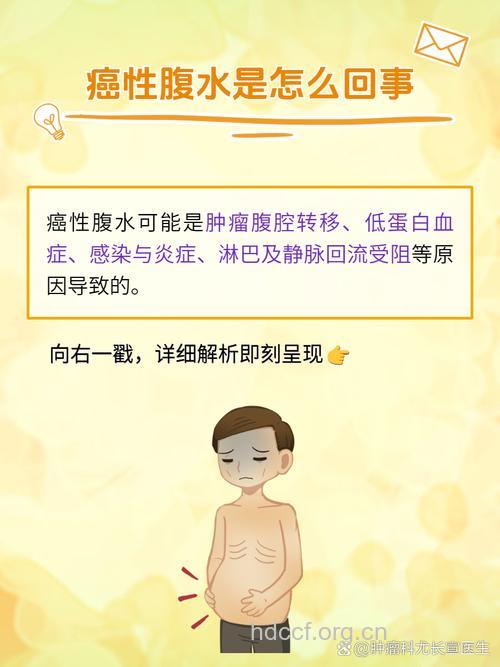 卵巢癌会产生腹水的原因