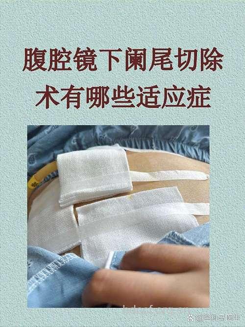 腹腔镜下切阑尾有哪些优点