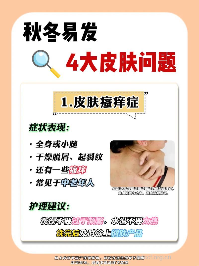 秋季皮肤病患者有哪些需要注意的