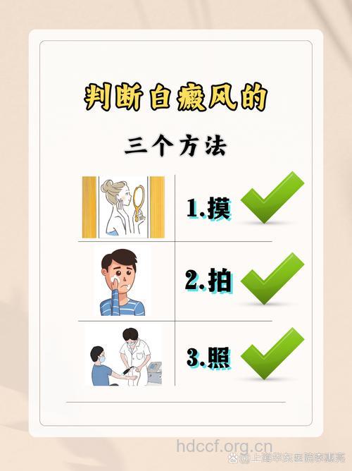 白癜风患者如何面对自己