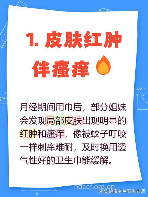 女性应注意月经期过敏问题