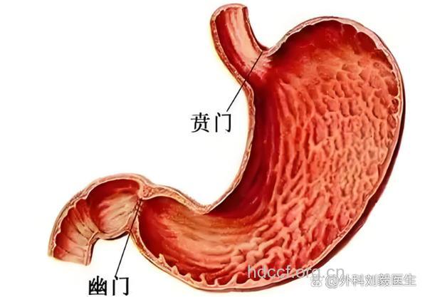 怎么诊断幽门性肠梗阻