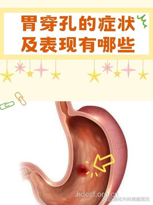 可怕胃穿孔 可治也可防