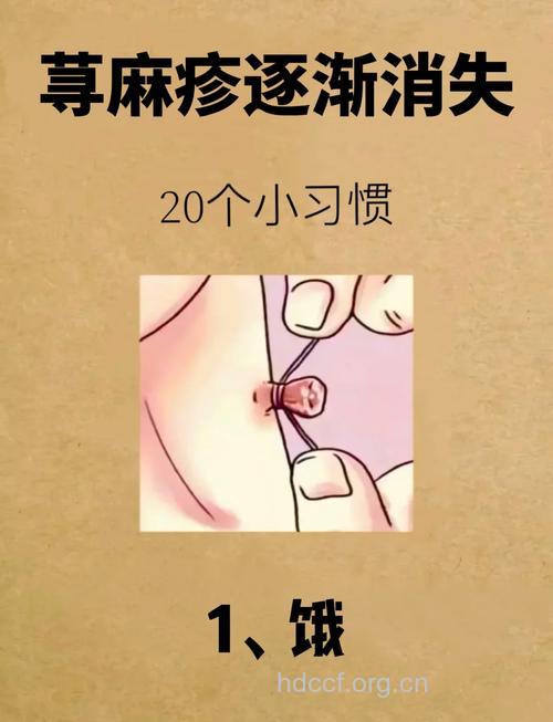 简单七招,让你和过敏说拜拜