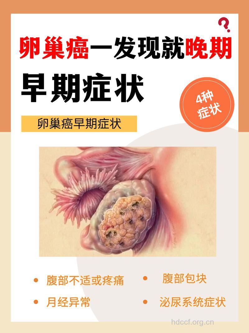 晚绝经晚的女性易患卵巢癌吗