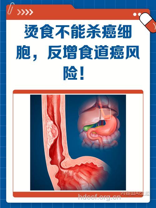 吃过烫食物 小心得了食道癌