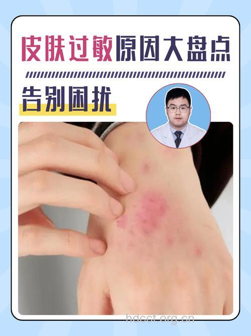 为什么会过敏 这些都是凶手