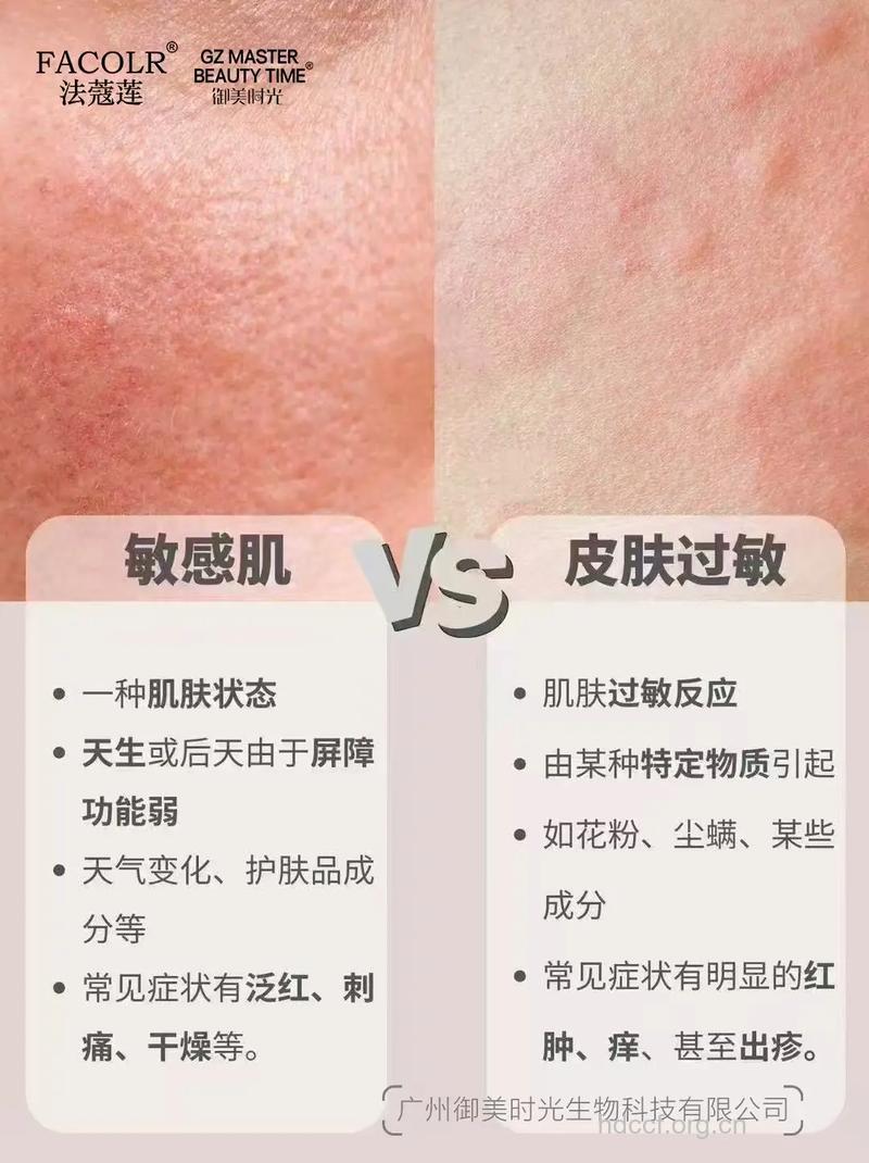 你的皮肤是过敏还是敏感 搞清楚了吗