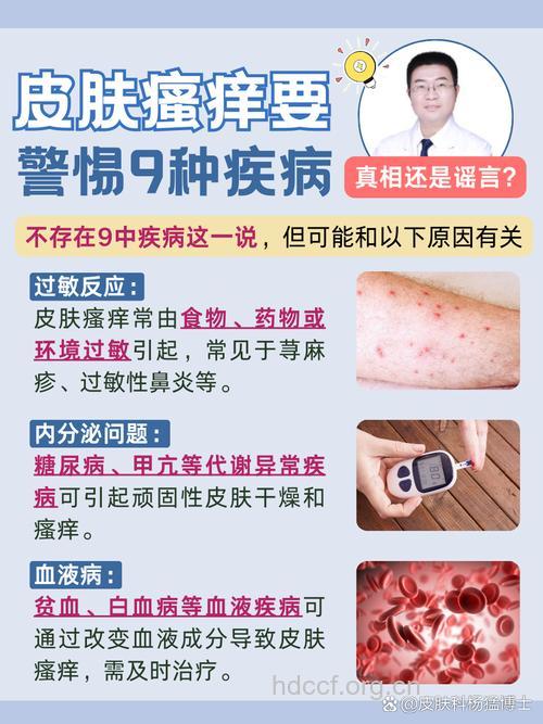 皮肤瘙痒对患者有不少的影响