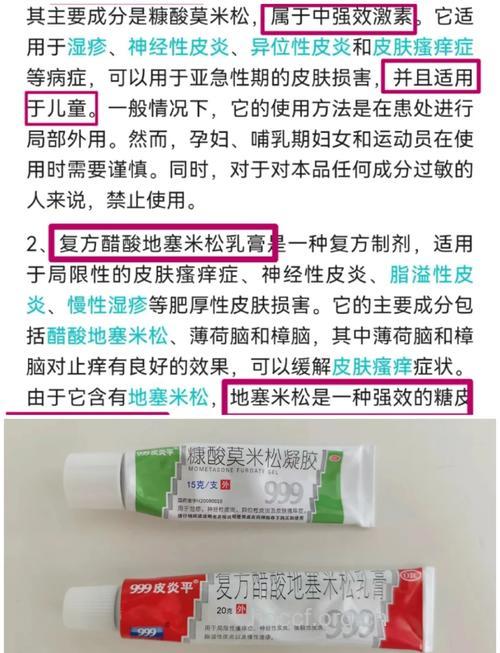 紫外线也会致过敏 如何治疗才好