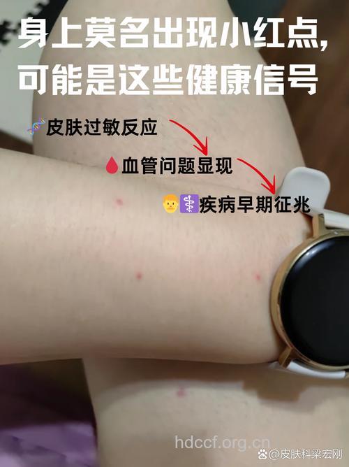 过敏也会影响心脏健康