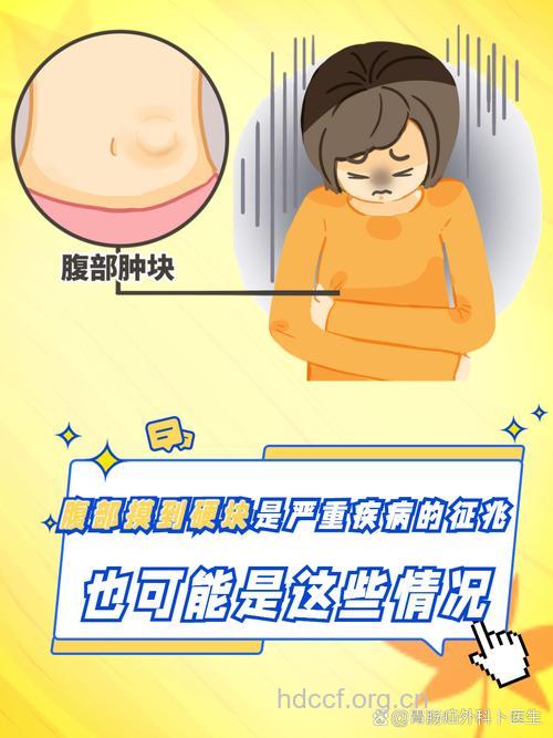 女人常摸肚子可早期发现癌