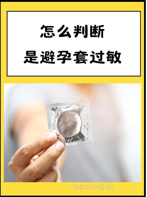 过敏性体质的人不宜带的两种“套套”