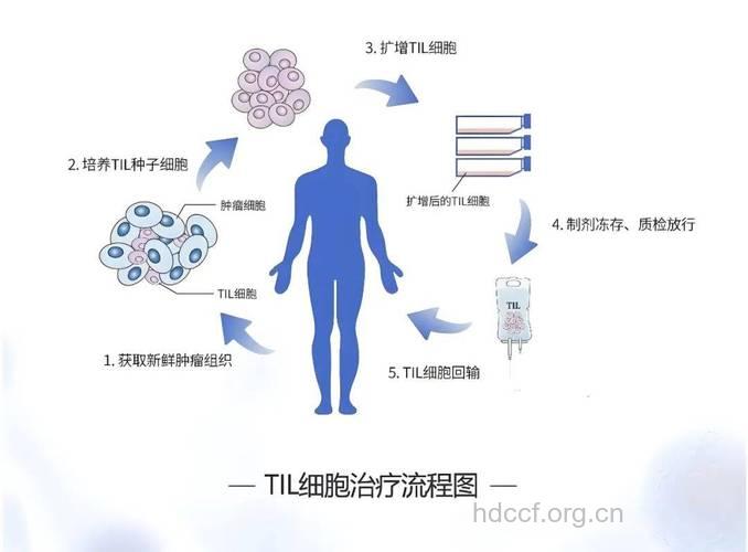 卵巢癌的治疗新方法-免疫治疗
