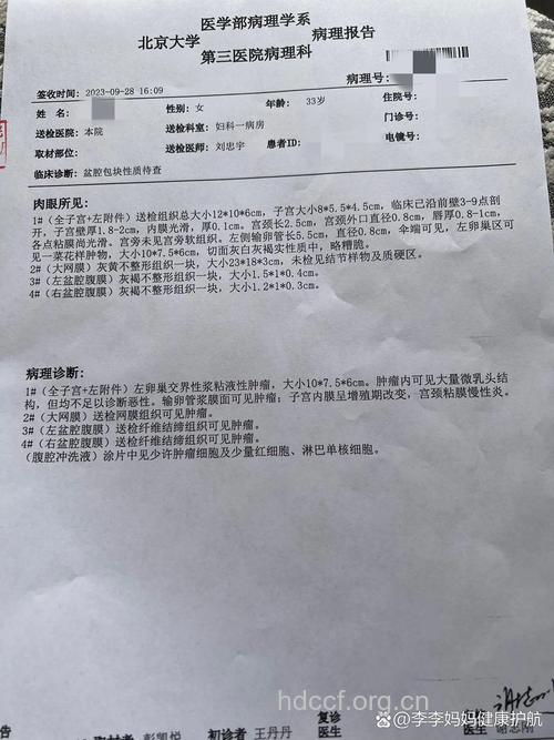 卵巢癌症状及相关检查