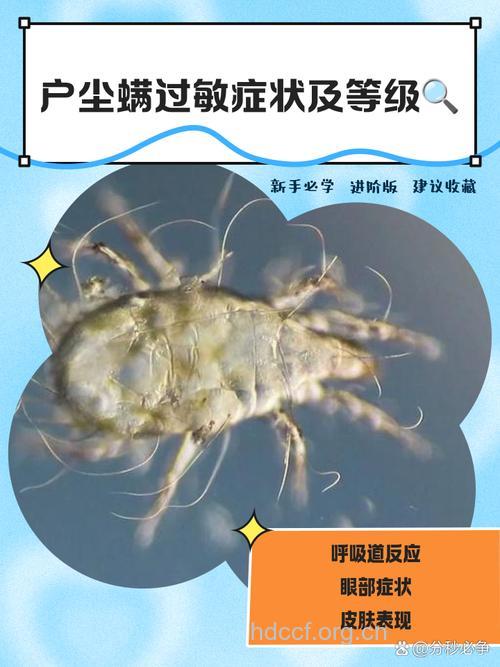 教你认识尘螨过敏的表现特点