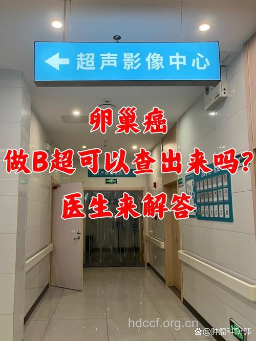 超声显影术筛选卵巢癌显优势