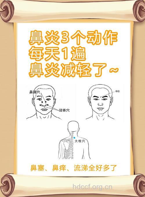 中医治疗鼻炎有3个妙招