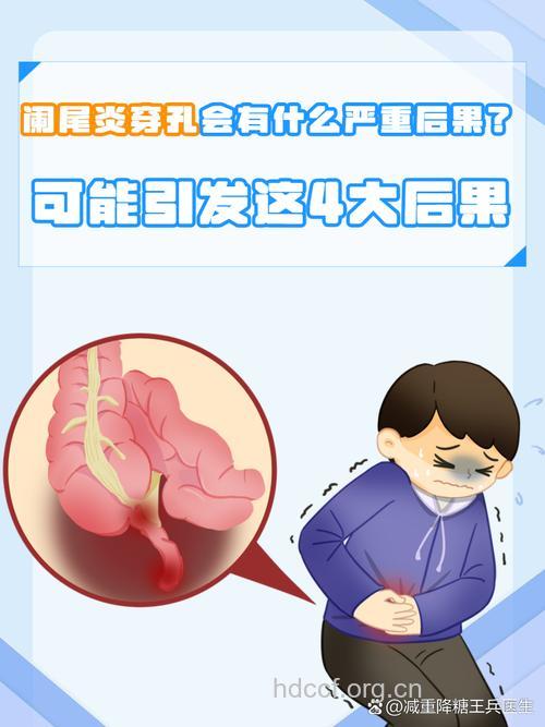 阑尾炎穿孔是宫外孕高危因素