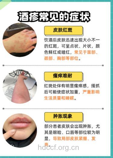 长期喝酒皮肤癌风险增大