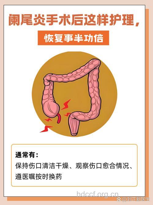 阑尾炎的家庭养护小招式