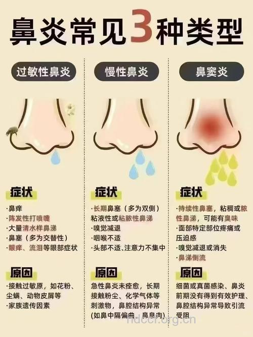 过敏性鼻炎的分类有哪些