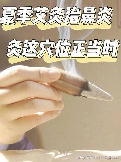 艾灸法治疗过敏性鼻炎