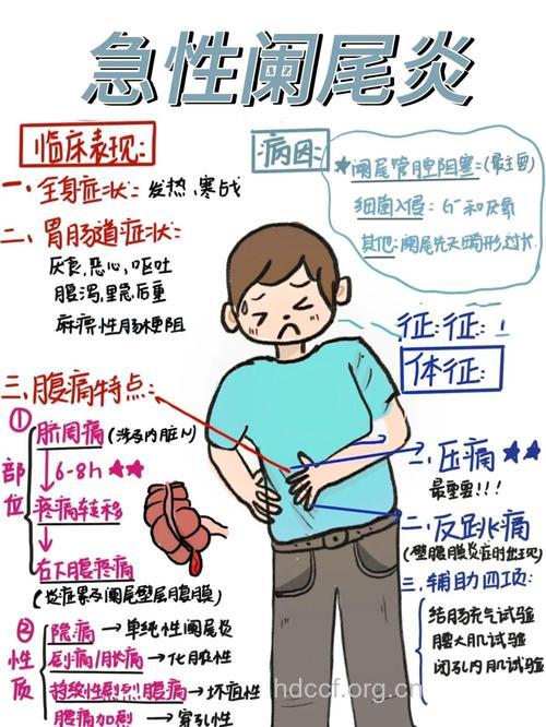 急性阑尾炎的症状及治疗方法